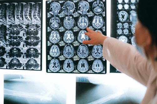 Use Cases of AI for Magnetic resonance imaging